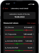 Laboratorní výsledky - Vlastnost